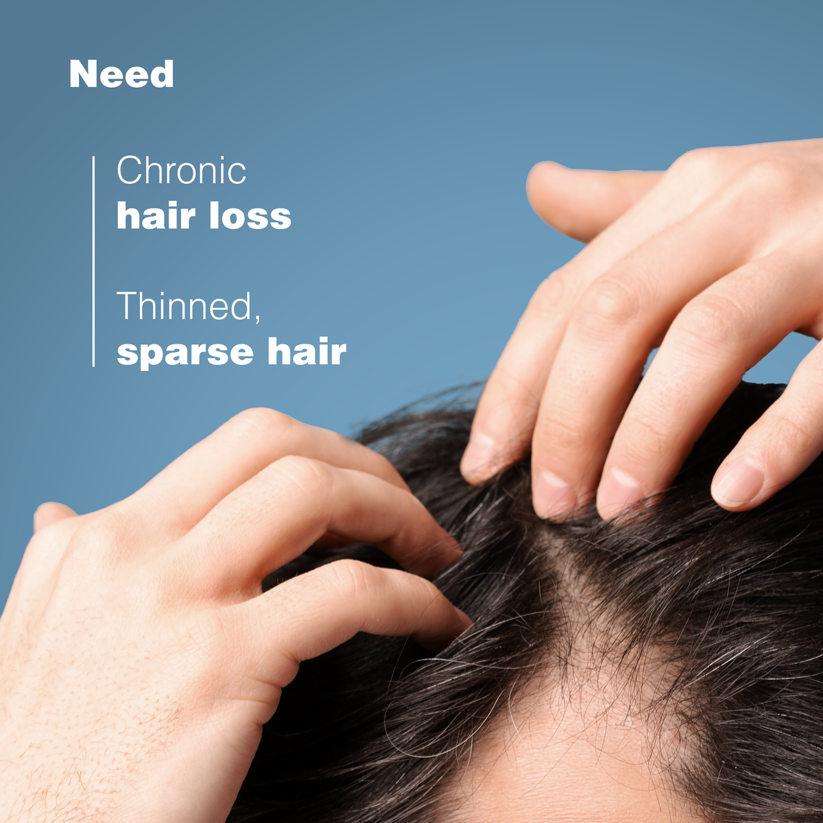 Ducray Anaphase Anti-hair loss Anti-thinning Shampoo - Ducray