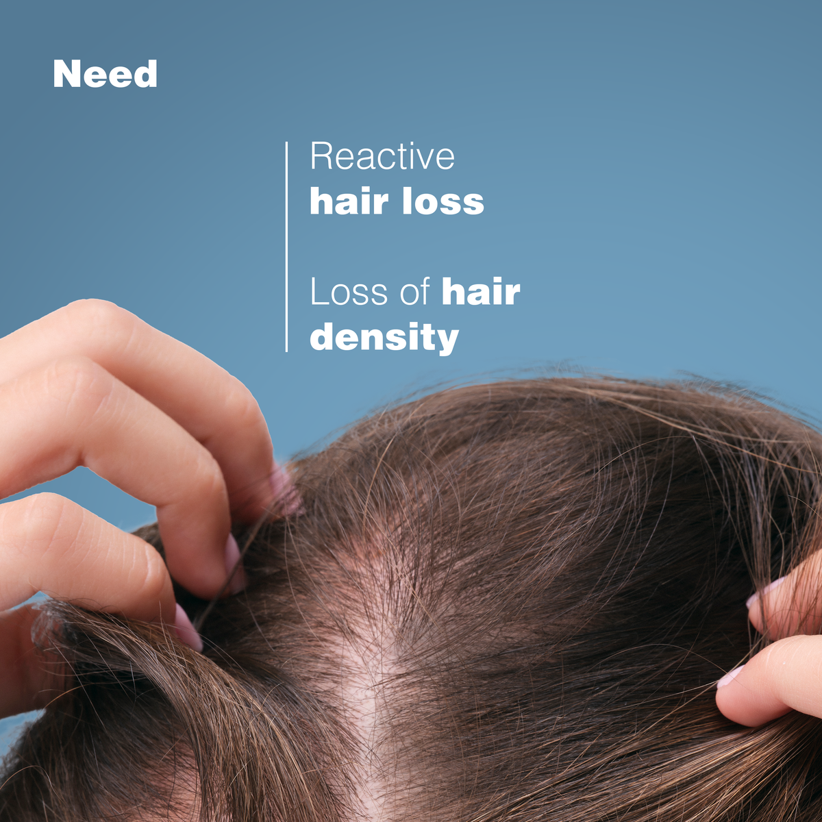 Ducray Anaphase Anti-hair loss Anti-thinning Shampoo - Ducray