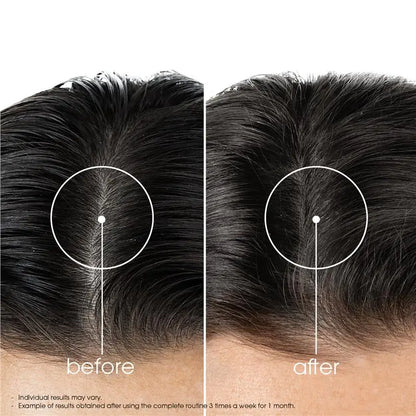 Klorane Quinine Conditioner - Klorane