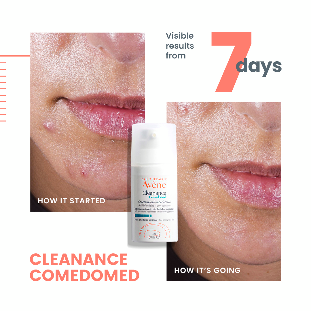 Avène Cleanance Comedomed Anti-Blemish Concentrate - Avène