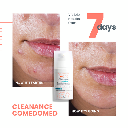 Avène Cleanance Comedomed Anti-Blemish Concentrate - Avène